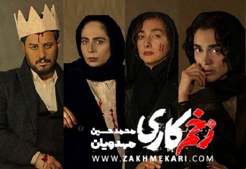 عکس های دیده نشده از خانم بازیگران زخم کاری در ترکیه!