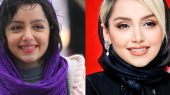 صورت نازنین بیاتی هم عملی از آب درآمد؛ لیست جراحی‌های این بازیگر لو رفت