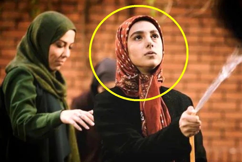 عکس/ تغییر چهره جوانه دلشاد پس از 10 سال شما را شوکه می کند
