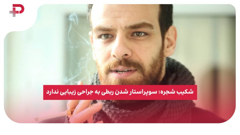 شکیب شجره: سوپراستار شدن ربطی به جراحی زیبایی ندارد 